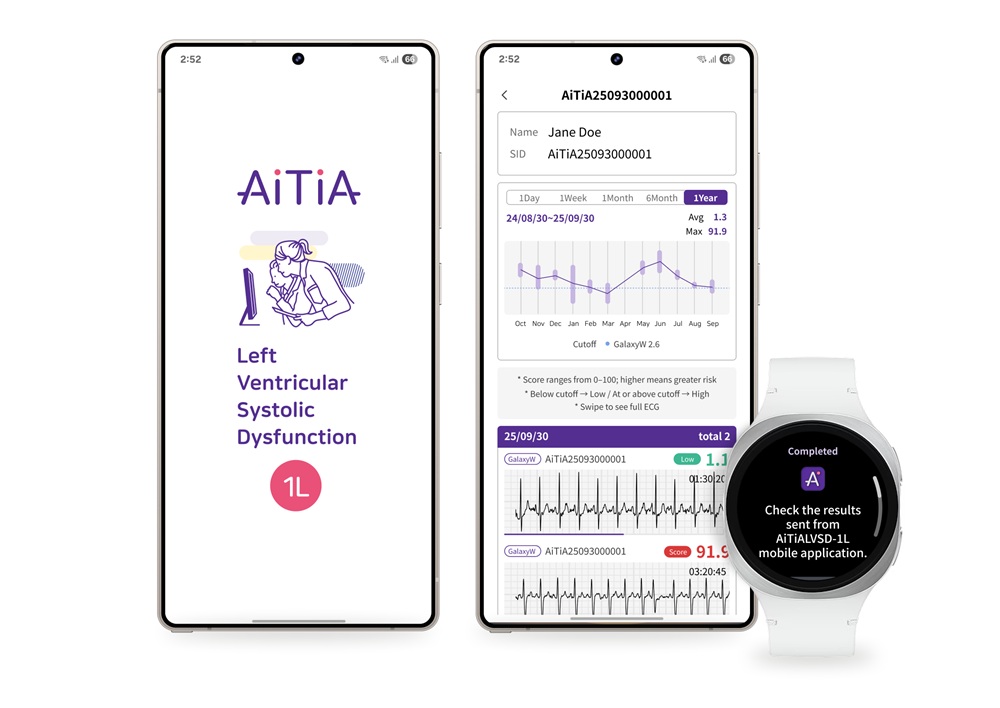 Samsung Lanza Deteccion De Dsvi En Los Galaxy Watch Un Avance Crucial En Salud Digital
